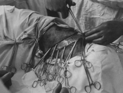 前苏联恐怖的“狗头移植”手术，不仅存活了，而且两个头都能进食